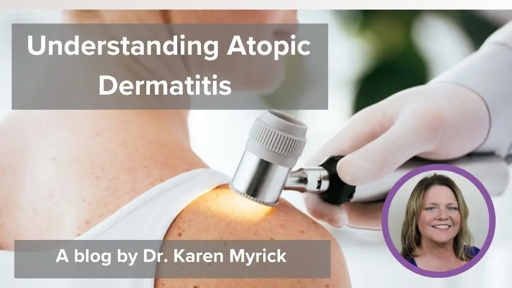 Understanding Atopic Dermatitis Springer Publishing