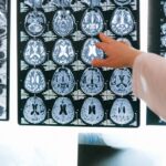 Radiologist pointing at brain MRI scans showing detailed medical examination.